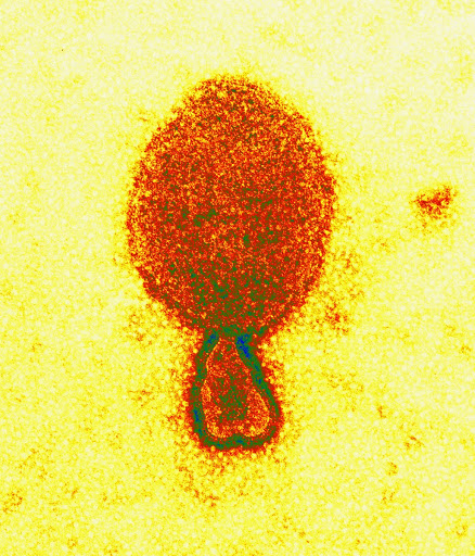 The Hendra Virus