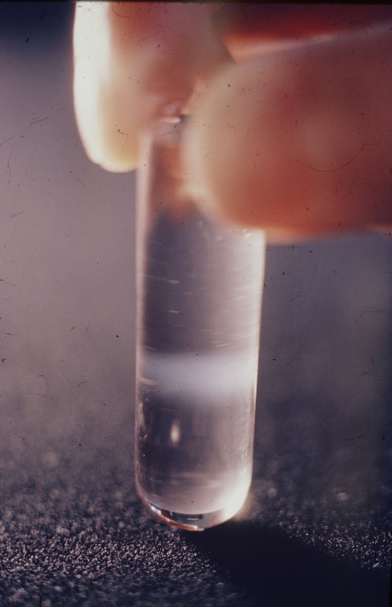 Leukemia Essay Part Ii