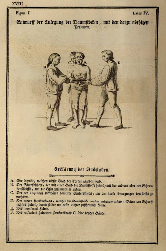 „Entwurff der Anlegung der Daumenstöcken, mit den darzu nöthigen Personen“