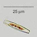 Epilithic Diatom