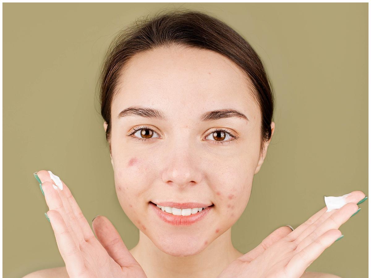 7 Best creams for dark spots to make your complexion bright and glowing |  PINKVILLA