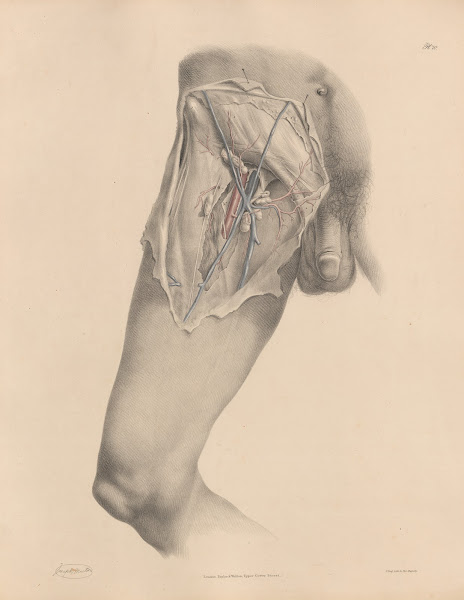 A view of the Femoral artery with the veins nerves and fascia 1844