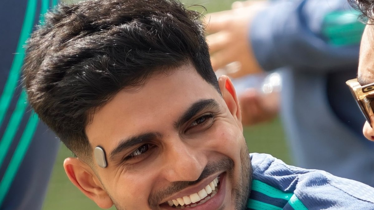Shubman Gill Temple Wearable: What the Forehead Device Does
