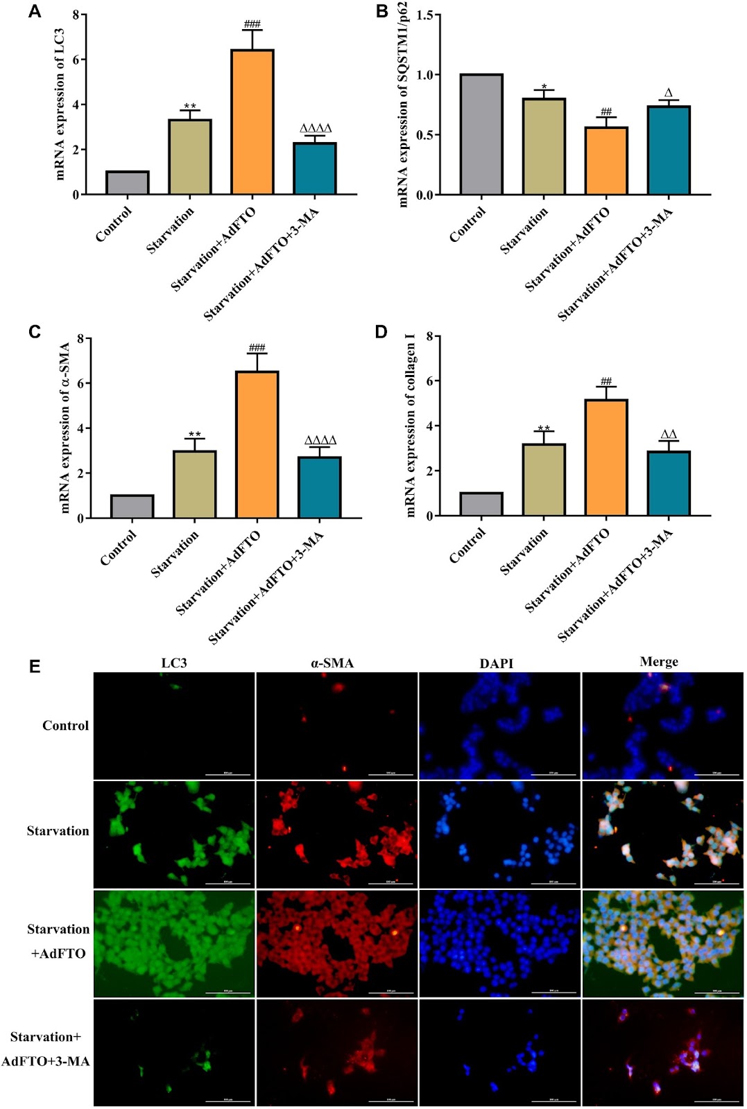 FTO-mediated m6A demethylation of ULK1 mRNA promotes autophagy and activation of hepatic stellate cells in liver fibrosis