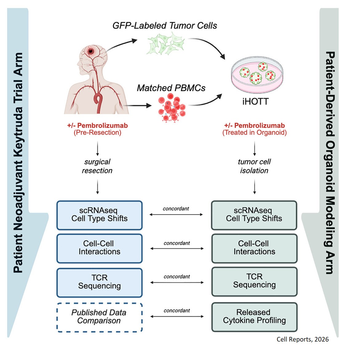 A human tumor-immune organoid model of glioblastoma