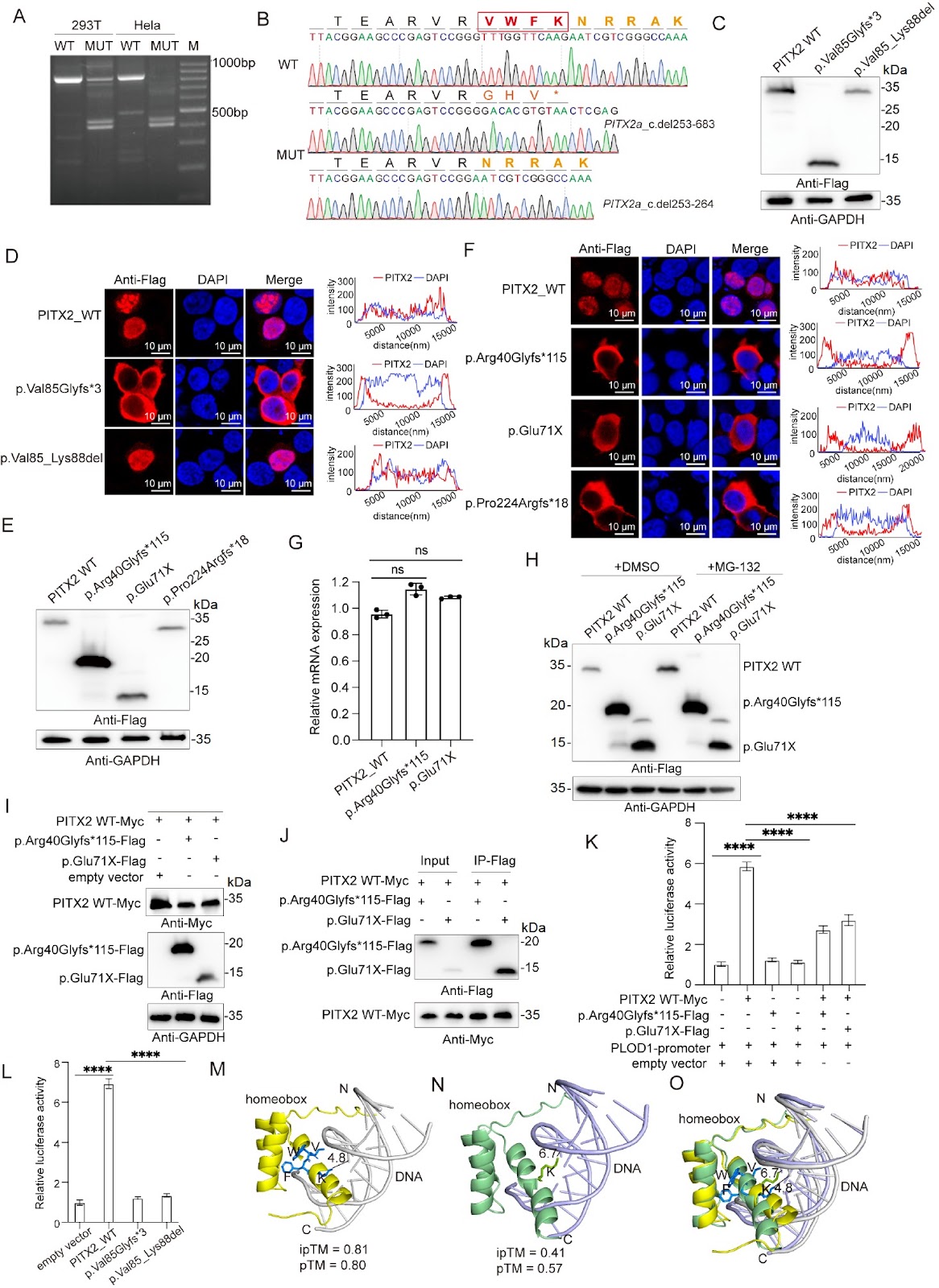Genetic characterization and functional analysis of novel PITX2 variants identified in Chinese families with Axenfeld-Rieger syndrome