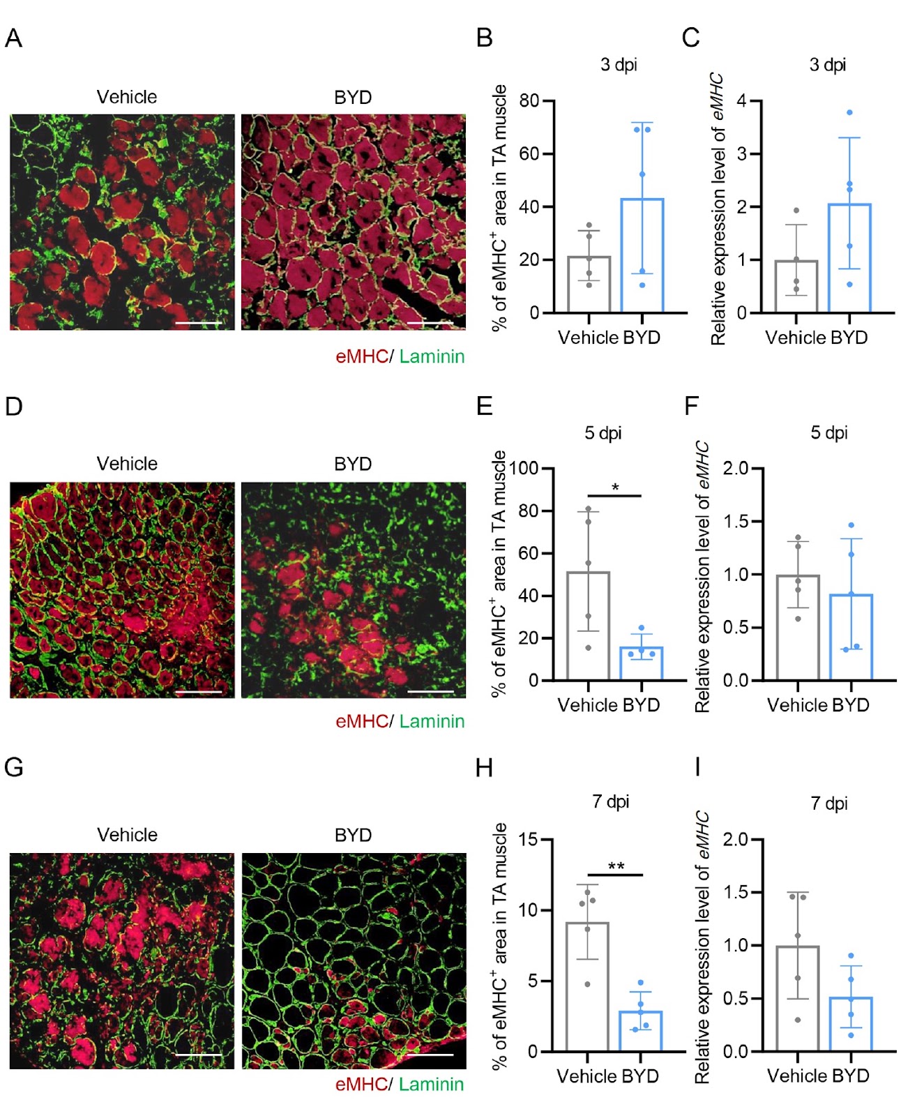 Buzhong Yiqi Decoction accelerates skeletal muscle regeneration