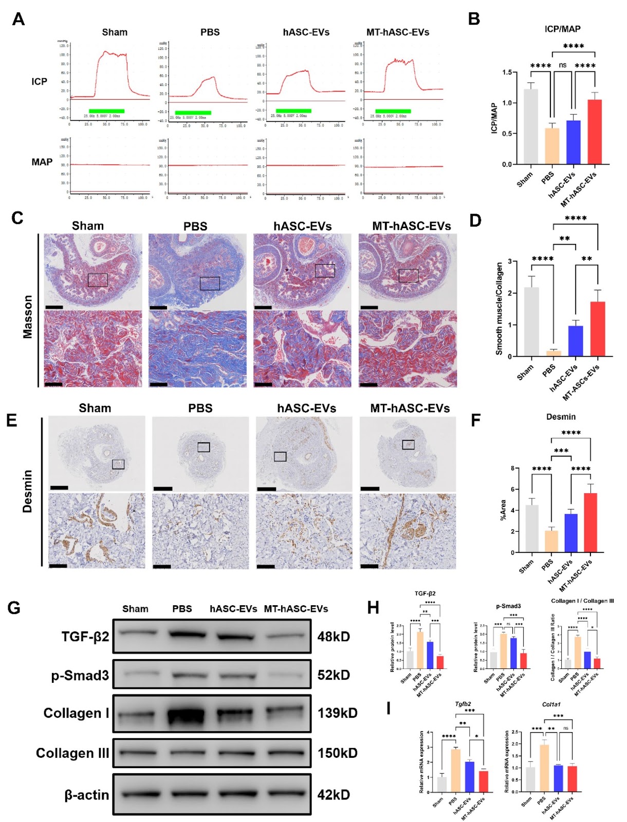 Melatonin-pretreated mesenchymal stem cell-derived exosomes alleviate cavernous fibrosis in a rat model of nerve injury-induced erectile dysfunction via miR-145-5p/TGF-β/Smad axis