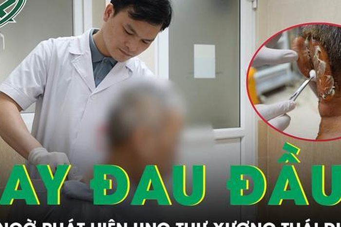 Đau đầu không dứt, người đàn ông bất ngờ phát hiện mắc ung thư xương thái dương - Báo Sức Khỏe &amp; Đời Sống