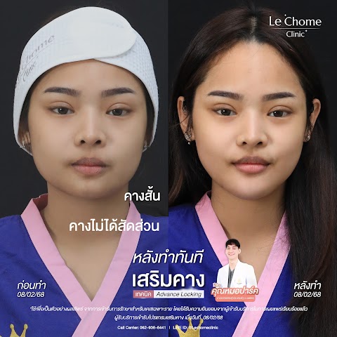 เสริมคาง (ใหม่)