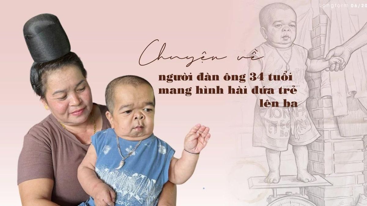 Chuyện về người đàn ông 34 tuổi mang hình hài đứa trẻ lên ba - Báo Tiền Phong