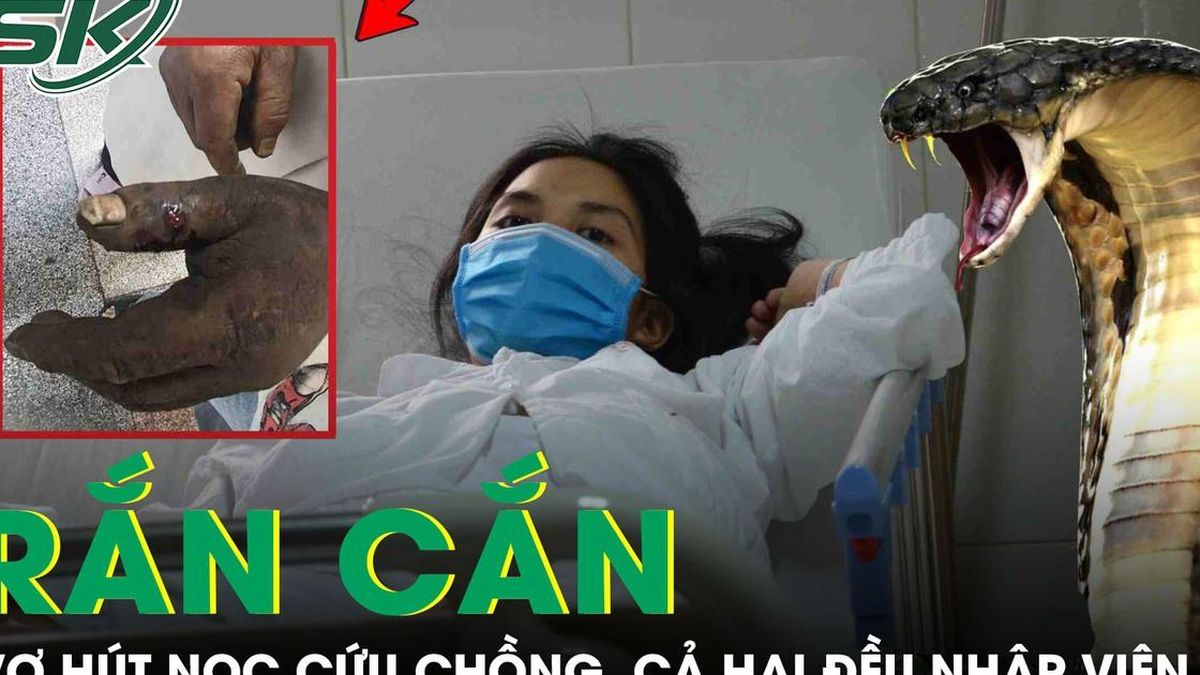 Hút nọc độc cứu chồng bị rắn cắn, cả hai cùng nhập viện vì sai lầm nhiều người mắc - Báo Sức Khỏe &amp; Đời Sống