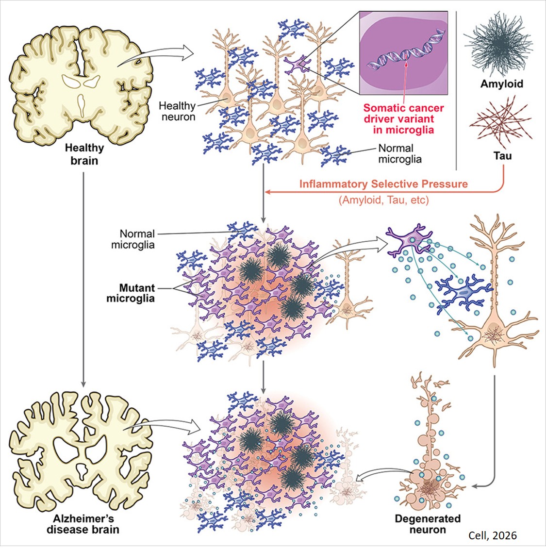 Somatic cancer variants enriched in Alzheimer’s disease microglia-like cells drive inflammatory and proliferative states
