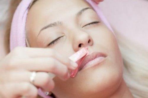 Epilation visage2
