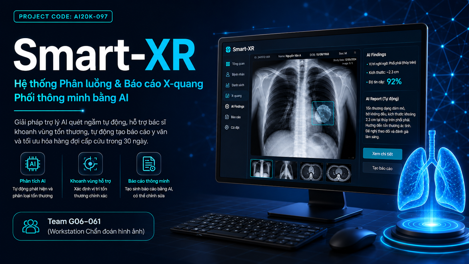 Smart-XR