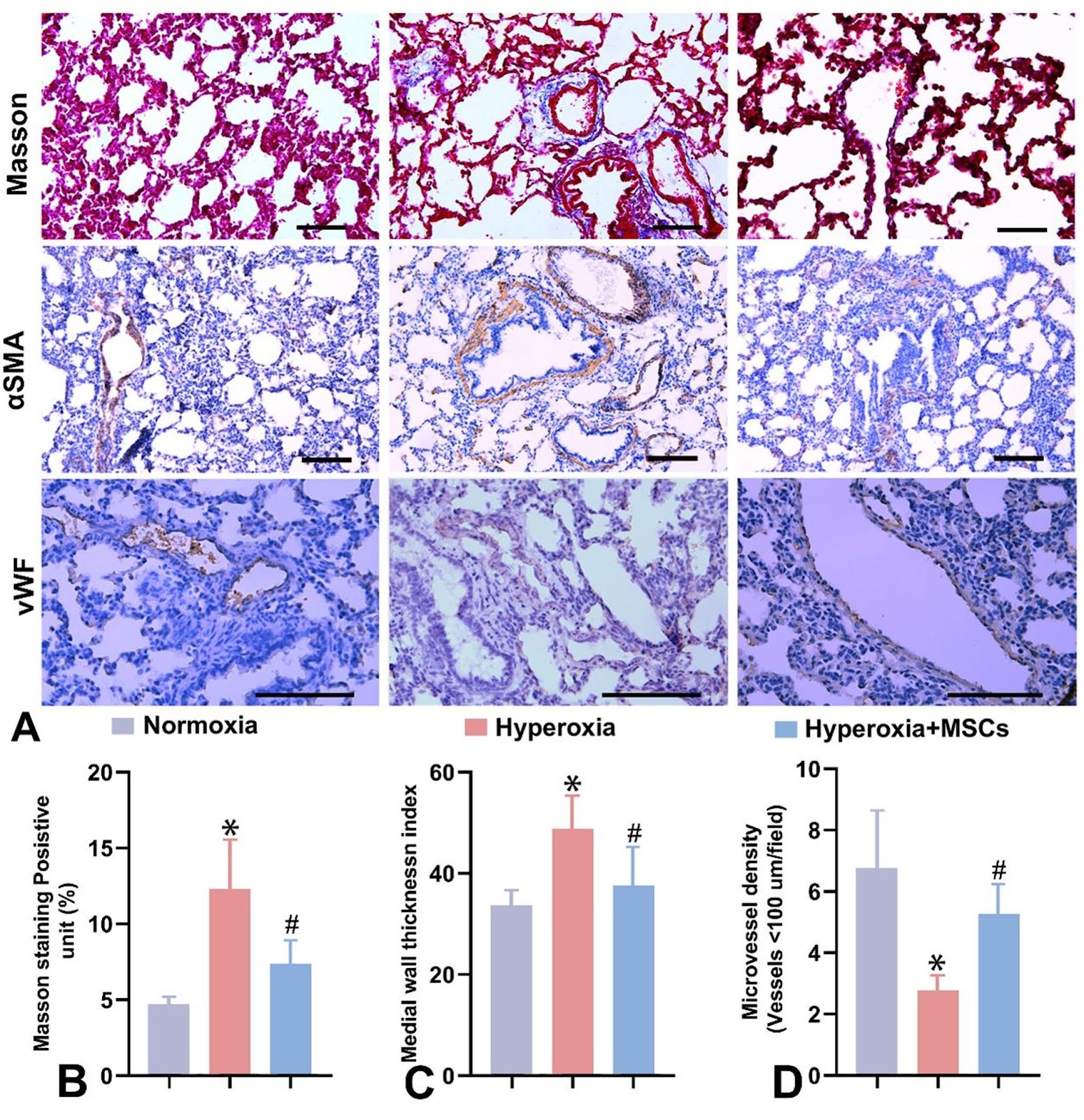 Intratracheal administration of mesenchymal stem cells ameliorates hyperoxia-induced bronchopulmonary dysplasia by inhibiting NLRP3 inflammasome activation: the critical role of Aldh1a2
