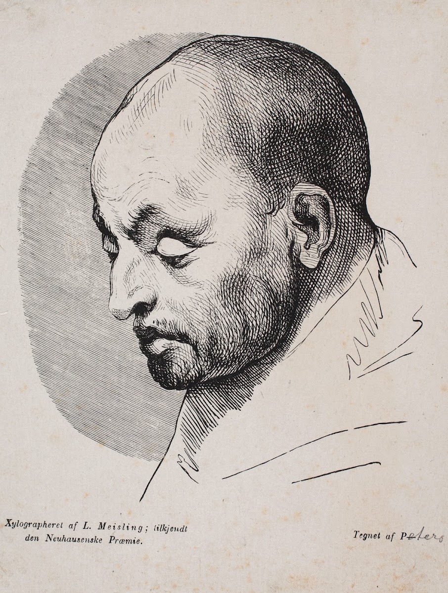 Hovedet af en skaldet mand 1846  1847