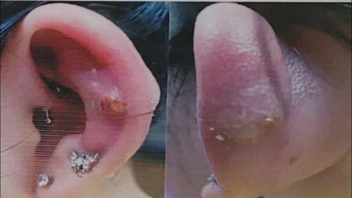 Bé gái nhập viện vì khuyên tai tụt sâu vào bên trong - Báo Tri thức &amp; Cuộc sống