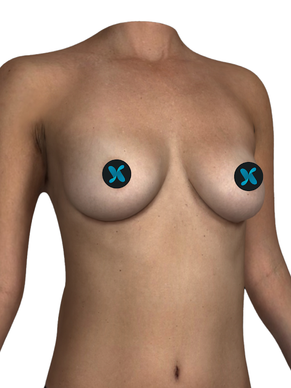Généré en 3D avec Crisalix.