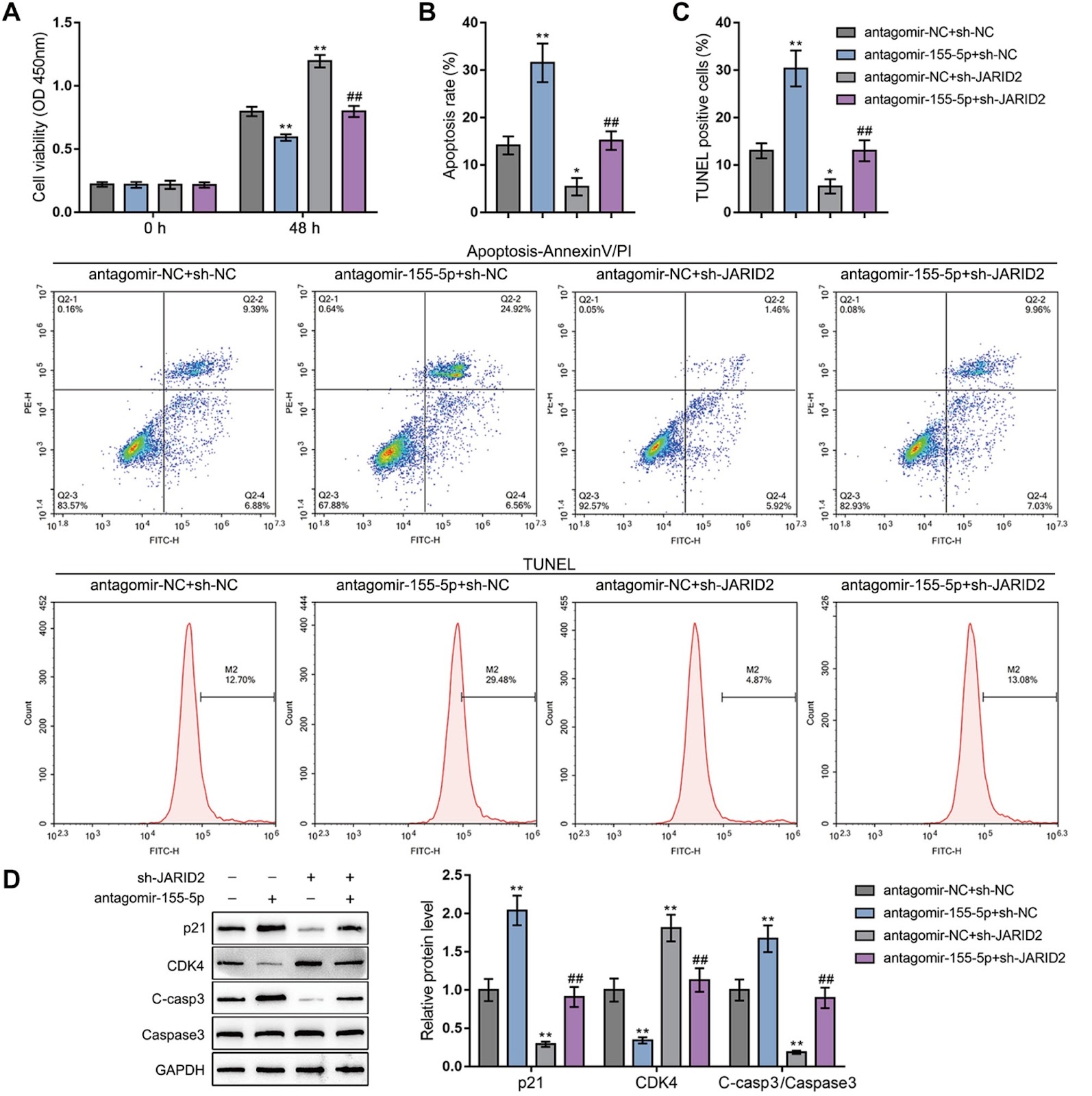 Valproic acid regulates the miR-155/Jarid2 axis by affecting miR-155 promoter methylation in glioma