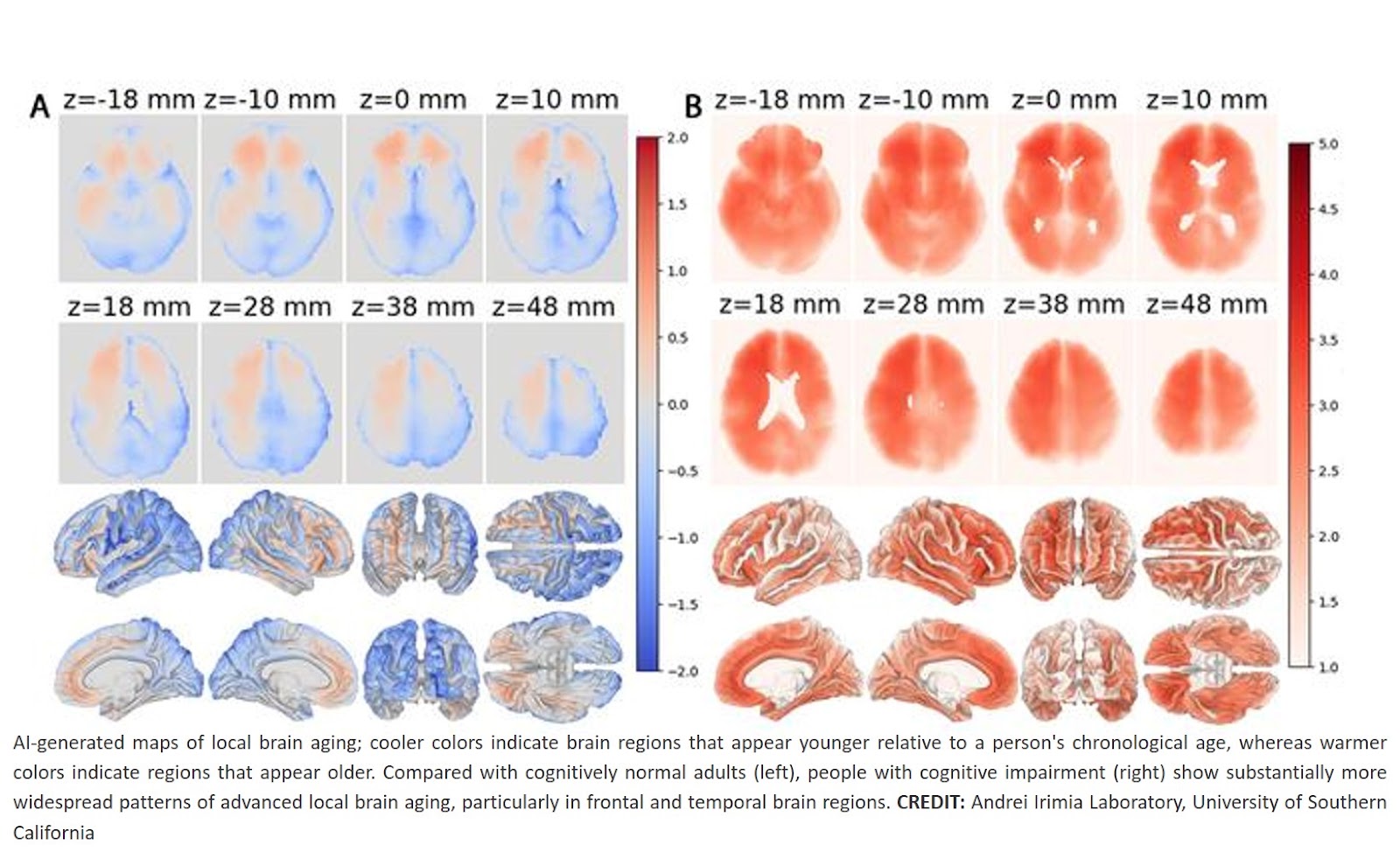 AI discovers variation in local brain aging and cognition across human adulthood