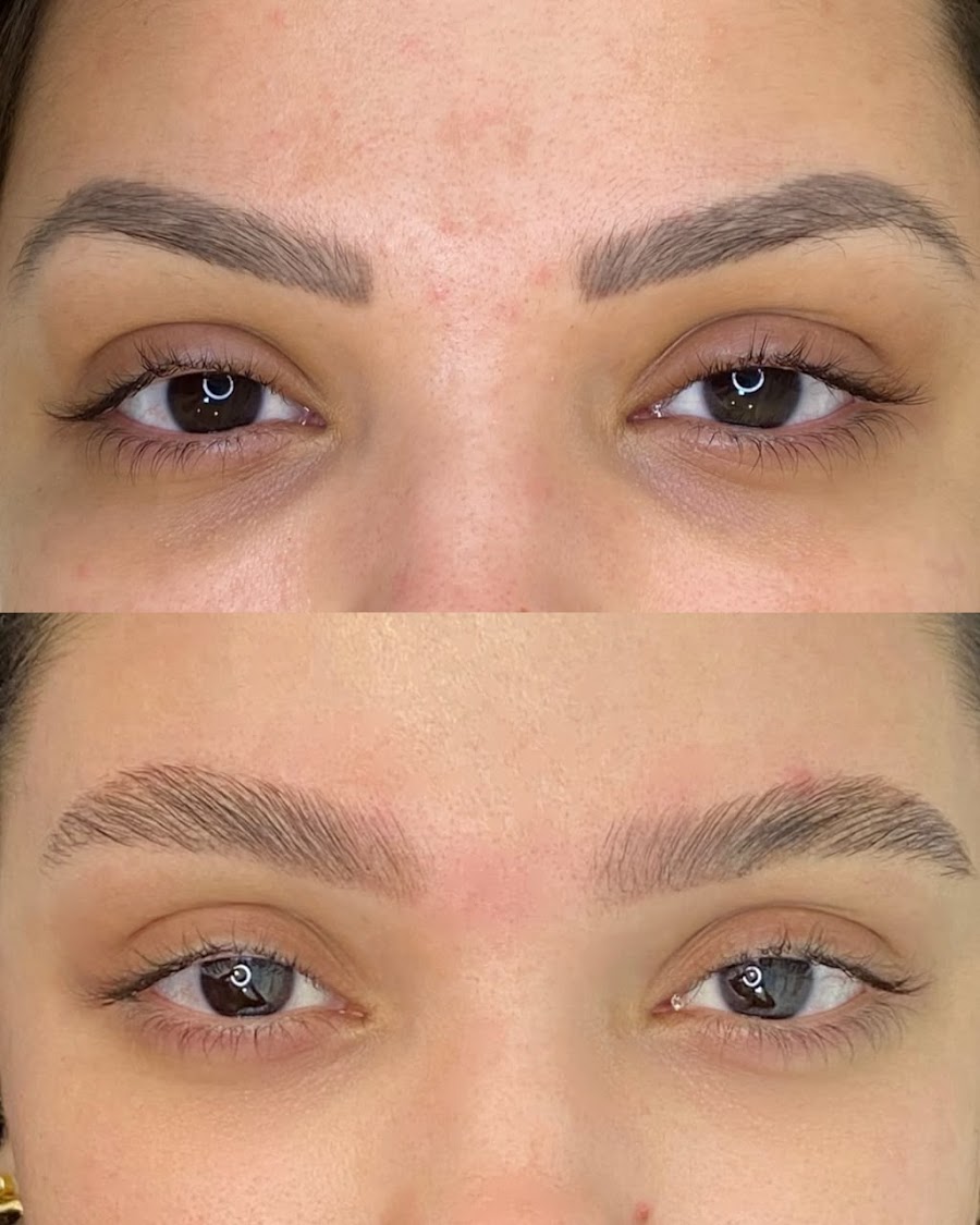 Antes e depois — reconstrução de sobrancelhas naturais