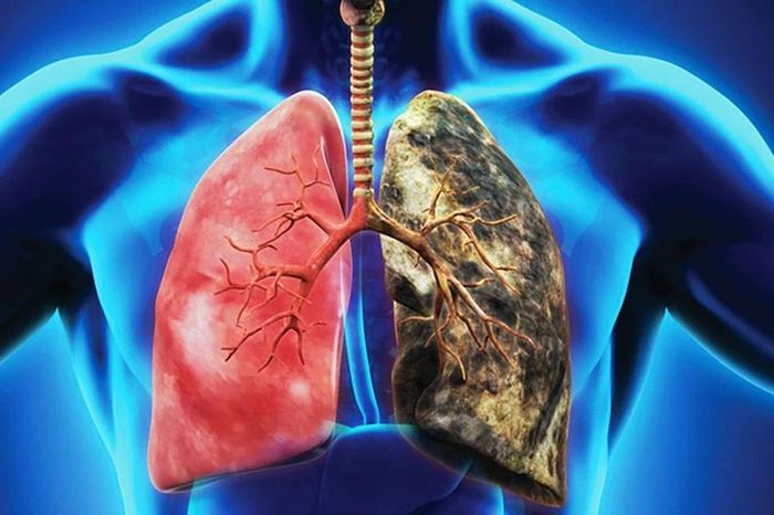 Việt Nam lọt nhóm 15 quốc gia có tỷ lệ nam giới hút thuốc cao nhất thế giới - Báo Tri thức &amp; Cuộc sống