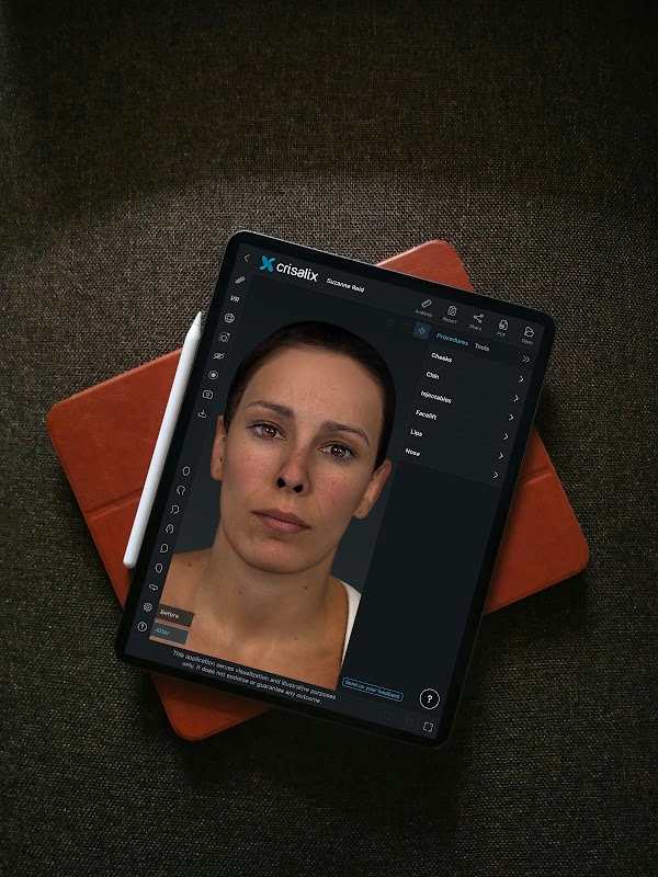 Tablette affichant l’interface de l’application Crisalix avec une simulation de visage 3D.