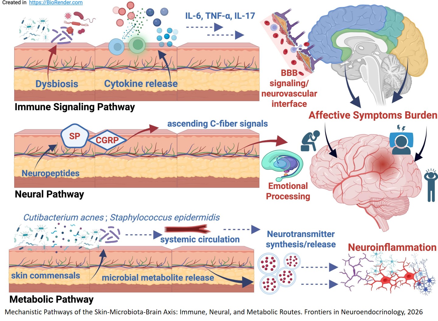 Skin-Microbiota-Brain-Axis in Chronic Inflammatory Skin Diseases