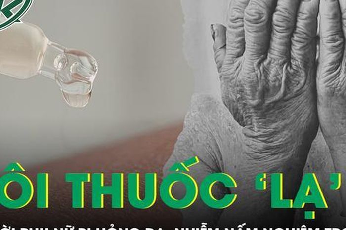 Người phụ nữ bị hỏng da, nhiễm nấm nghiêm trọng sau khi bôi 'thuốc lạ' - Báo Sức Khỏe &amp; Đời Sống