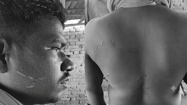 रौतहटमा माछा फर्मका कामदारमाथि छुरा प्रहार