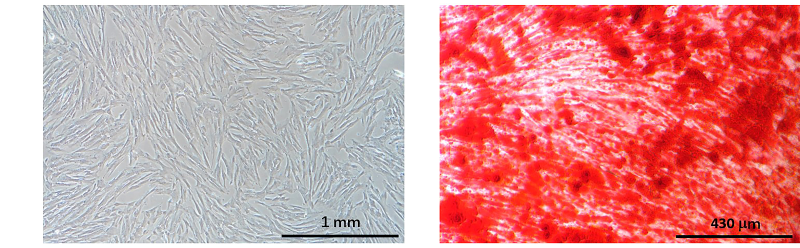 Human umbilical cord mesenchymal stem cell transplantation protects against reproductive damage induced by high-altitude hypoxia exposure in male mice