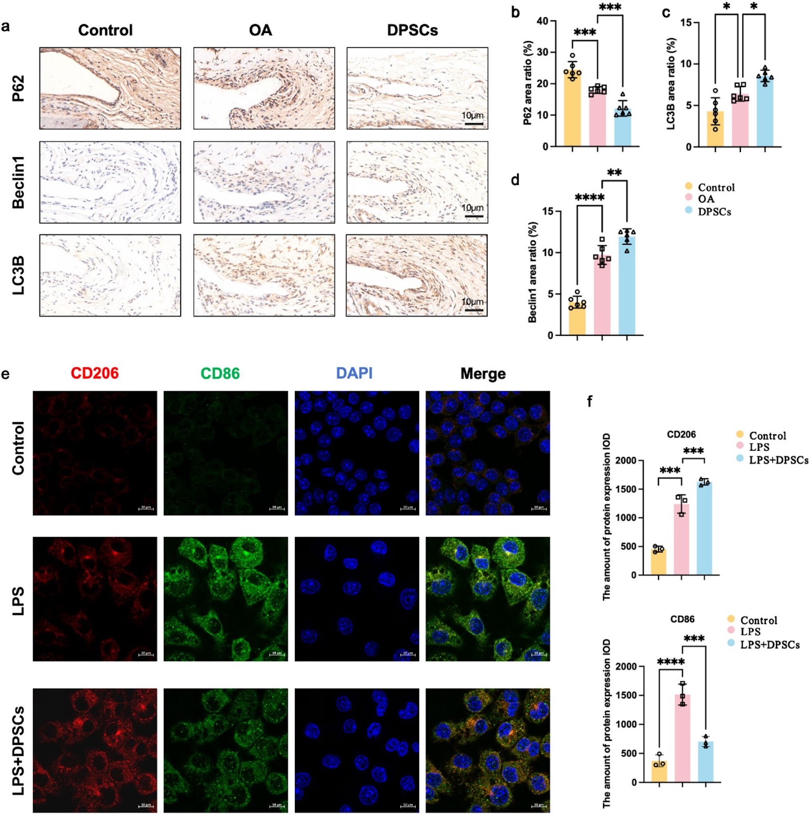 Correction: DPSCs modulate synovial macrophage polarization and efferocytosis via PINK1/Parkin-dependent mitophagy