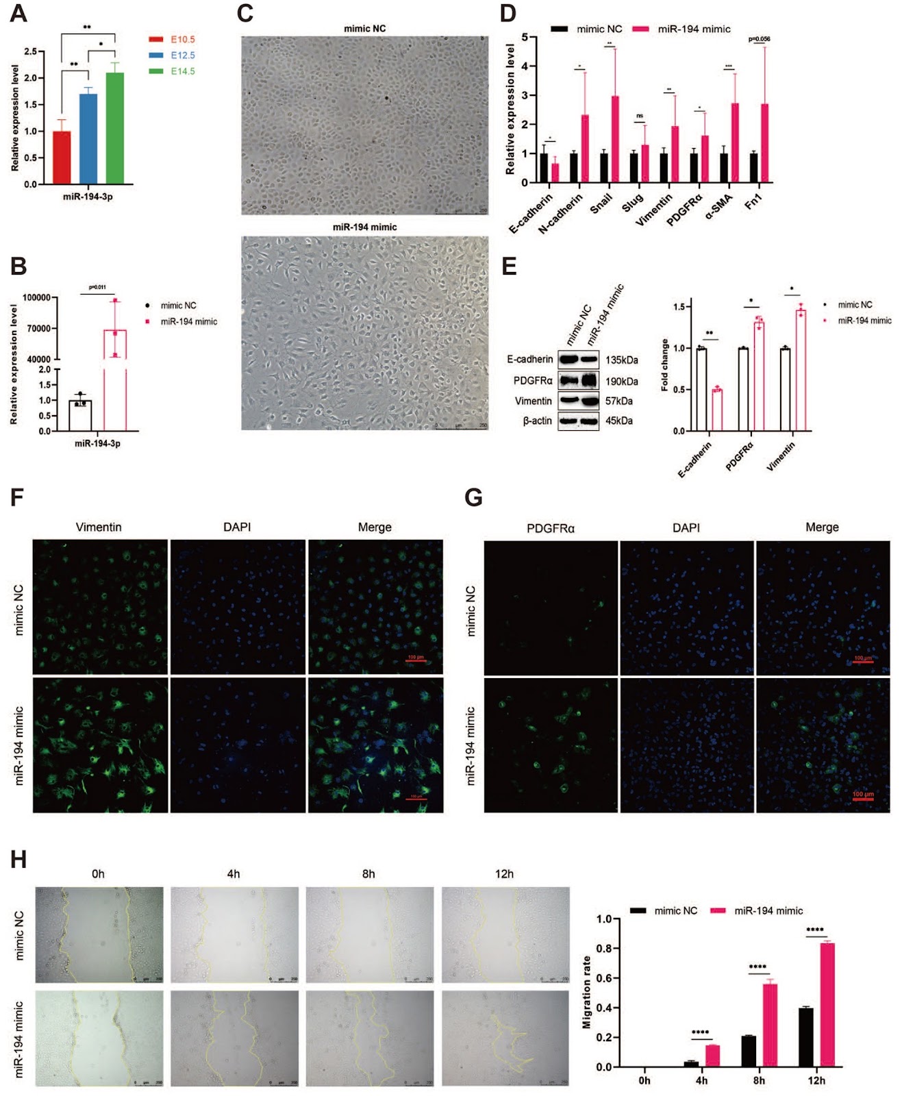 miR-194-3p regulates epithelial-mesenchymal transition in embryonic epicardial cells via p120/β-catenin signaling
