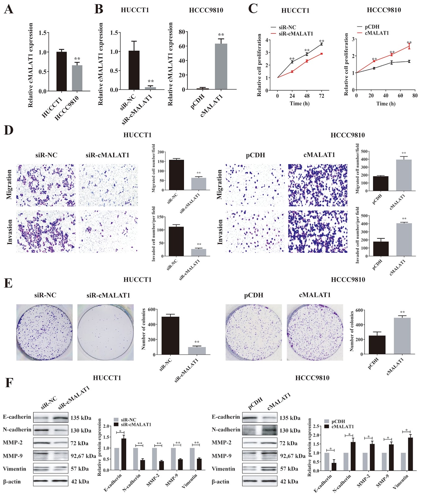 CircMALAT1 promotes the proliferation and metastasis of intrahepatic cholangiocarcinoma via the miR-512-5p/VCAM1 axis