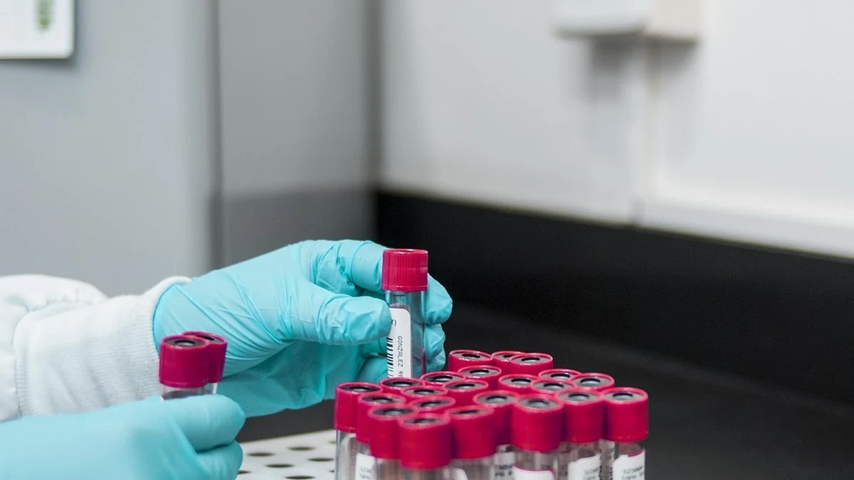 건강검진 주요 수치별 간 기능 이상 초기 진단 기준