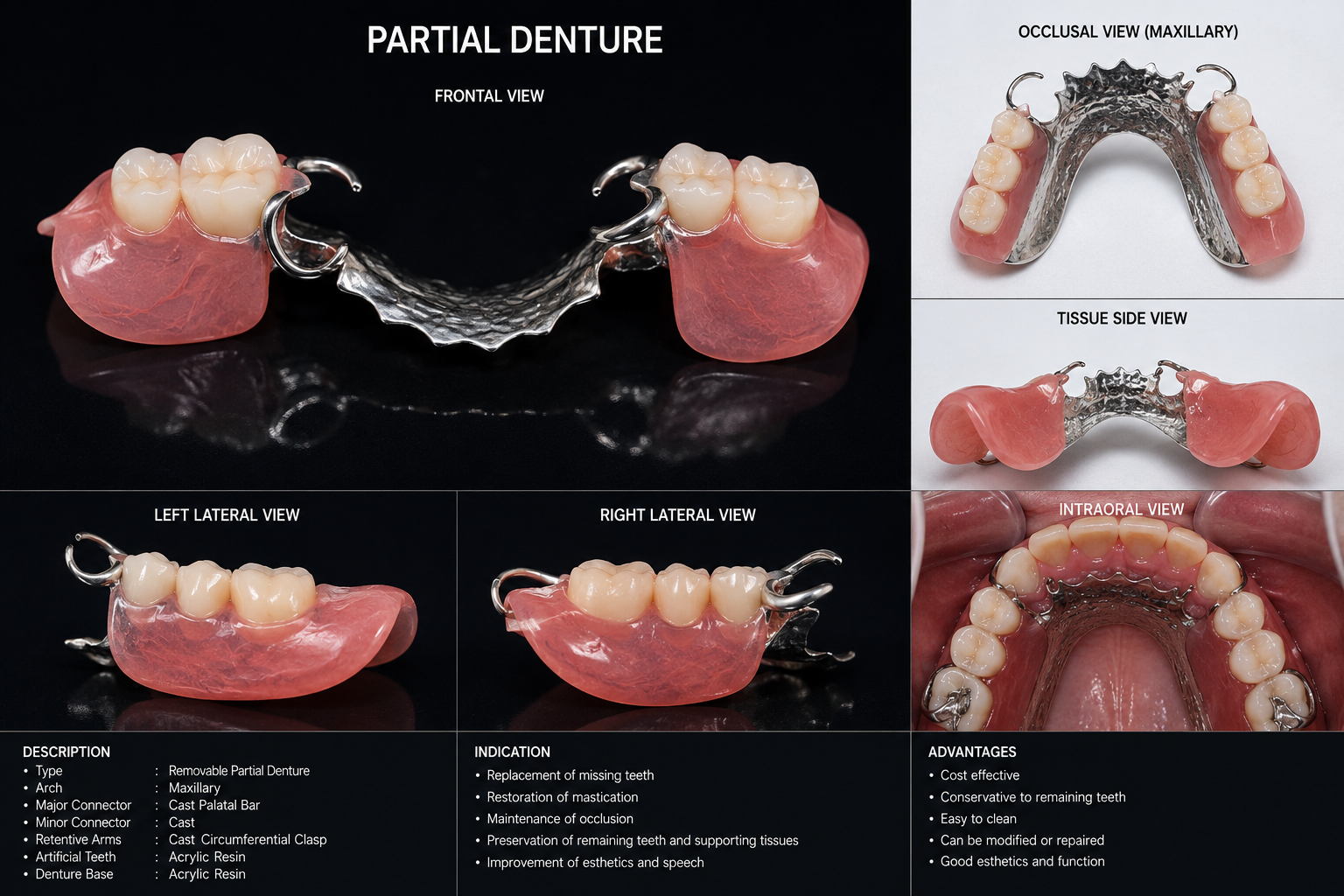 Complete and partial removable dentures
