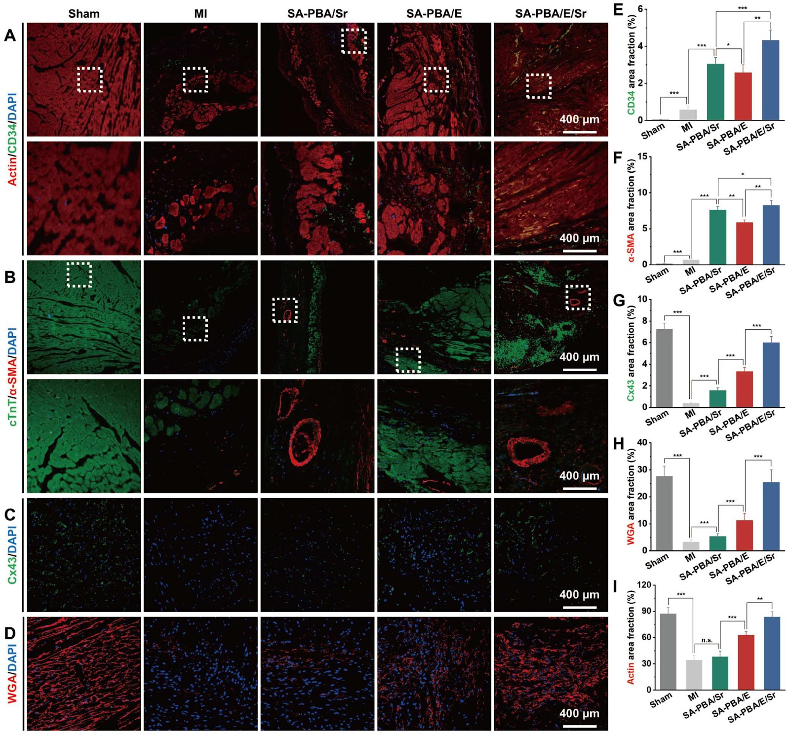A Dual-Dynamically Crosslinked Hydrogel for Cardiac Repair with Microenvironment Regulation and Angiogenic Functions