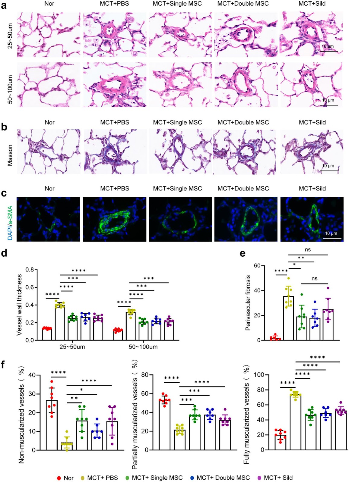 Mesenchymal stromal cells alleviate pulmonary arterial hypertension by suppressing pulmonary arterial adventitial fibroblast activation and extracellular matrix remodeling via the SOCS3/STAT3 pathway