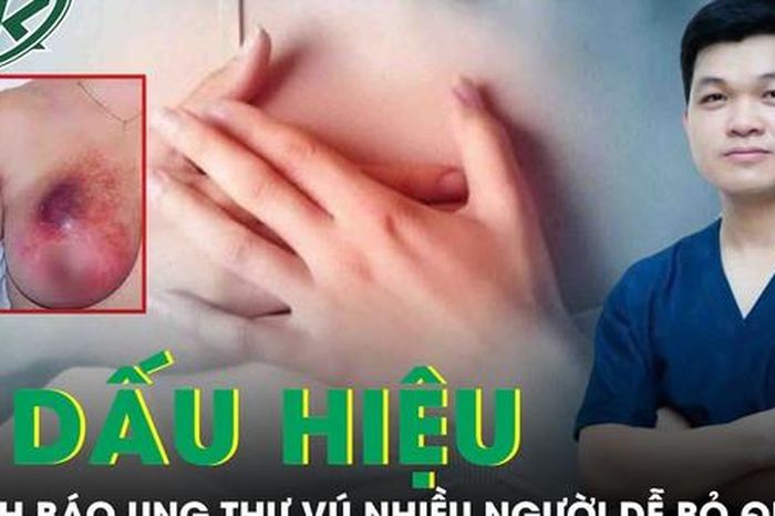 5 dấu hiệu âm thầm cảnh báo ung thư vú nhiều người dễ bỏ qua - Báo Sức Khỏe &amp; Đời Sống