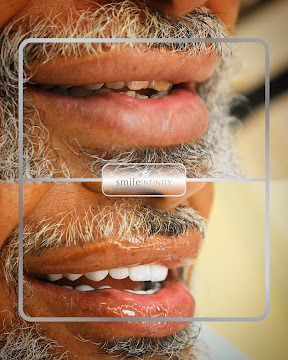 Hollywood smile teeth whitening Lebanon 2026 — Ferrari Dental Clinic Dr. Habib Zarifeh