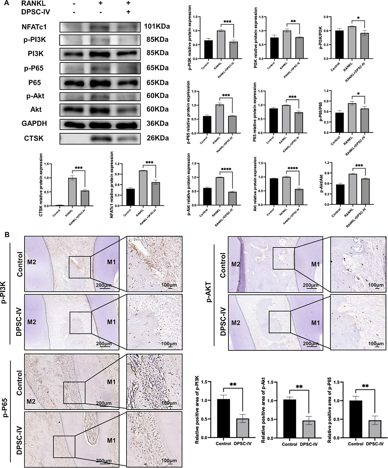Dental pulp stem cell-derived intracellular vesicles prevent orthodontic relapse by inhibiting PI3K/Akt/NF-κB-mediated osteoclast activity