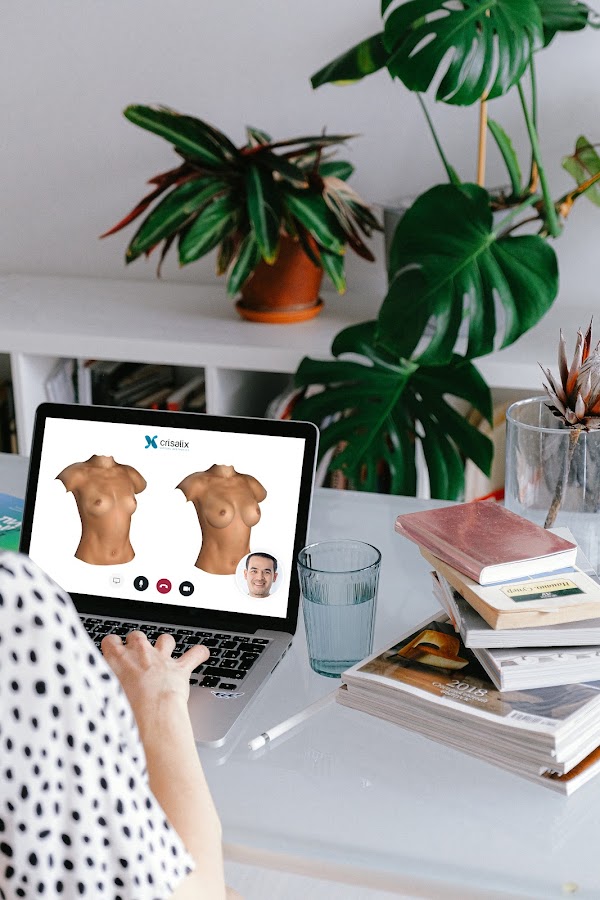 Patiente assistant à une consultation vidéo avec un médecin tout en regardant une simulation mammaire 3D dans l’application Crisalix sur un ordinateur portable.