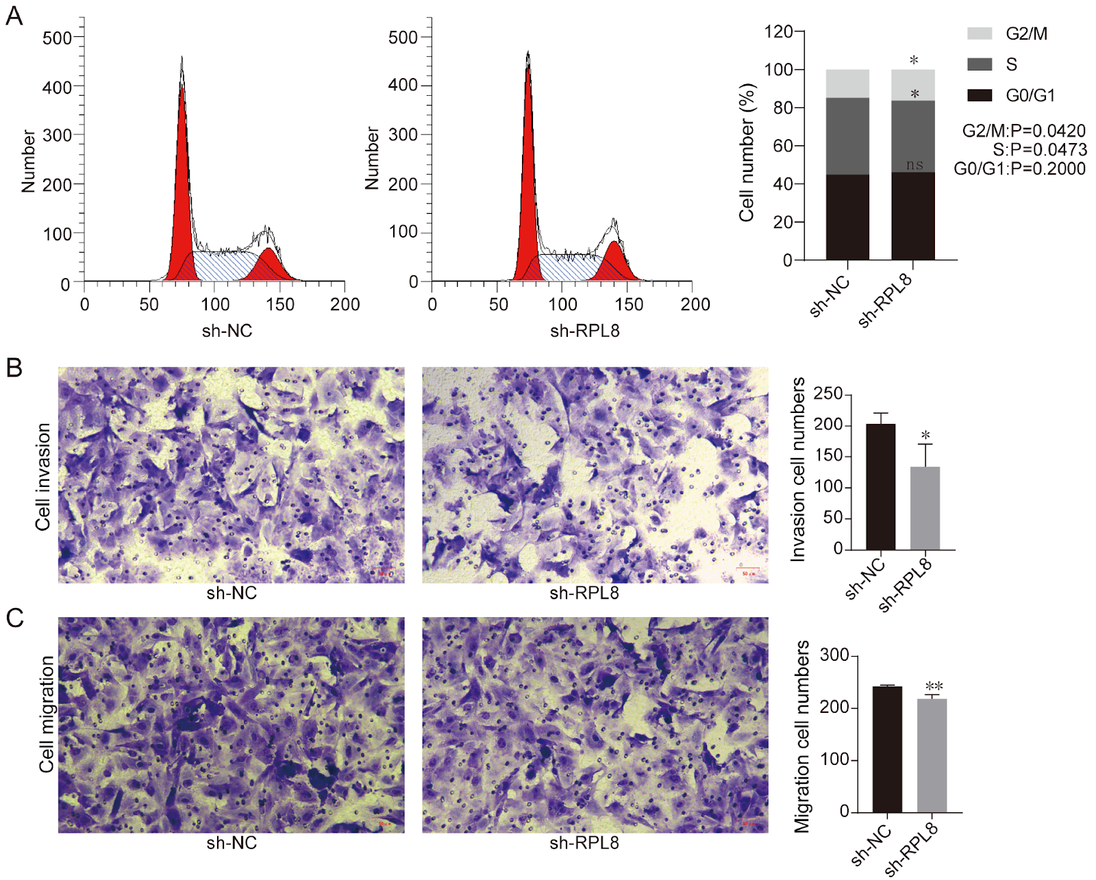 Ribosomal protein L8 promotes melanoma progression by regulating the cell cycle and metastasis