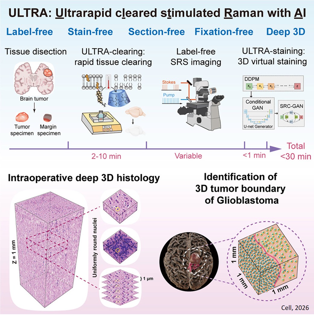 AI based imaging to see tumor boundaries in 3D within 30 minutes