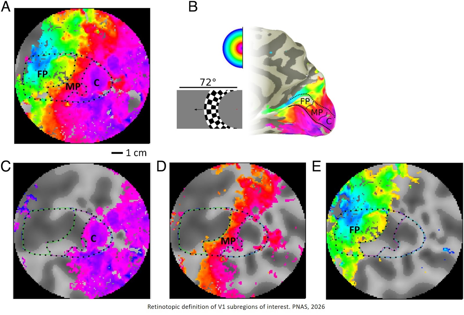 Retinotopic remapping of the visual system in deaf adults