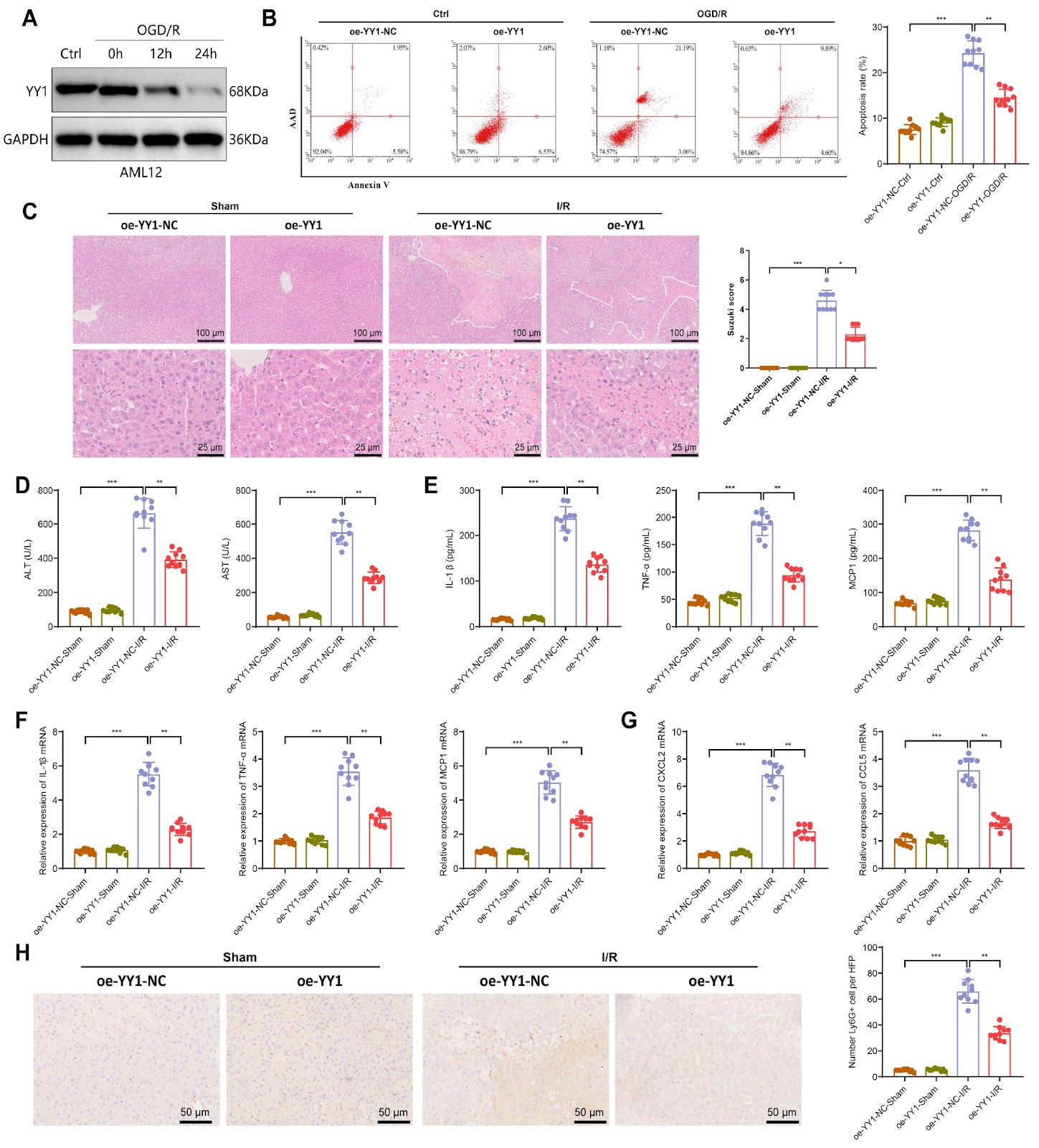 Modulation of ferroptosis via YY1-SLC7A11 axis in hepatic ischemia-reperfusion injury pathogenesis