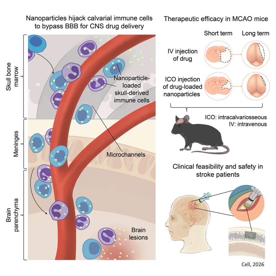 Nanoparticles hijack skull immune cells to bypass the blood-brain barrier for brain drug delivery