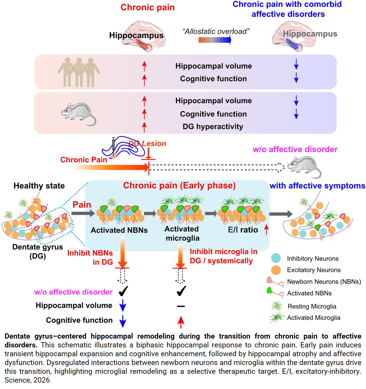 Why chronic pain leads to depression for some but not others   