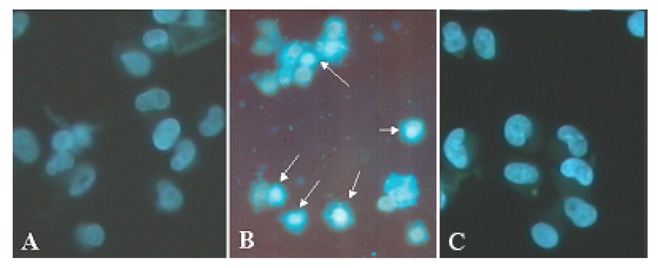 Corrigendum to: Overexpression of PTEN induces cell growth arrest and apoptosis in human breast cancer ZR-75-1 cells